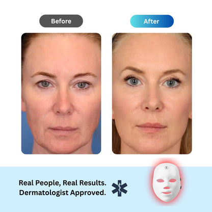 Anti-Aging Red Light Mask